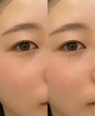 マツエク・マツパ Runoa eye 柿崎流依のマツエク・マツパデザイン