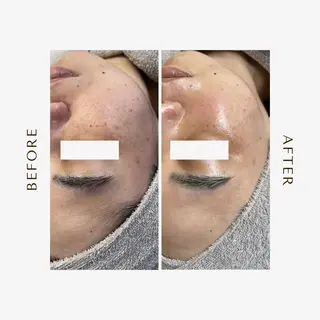 1st｜フェイシャル エステ専門店のエステ・リラクイメージ