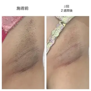 ビューティー ミロワールのエステ・リラクイメージ