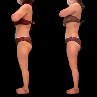 【脳洗浄/痩身】 nature東金のエステ・リラクイメージ