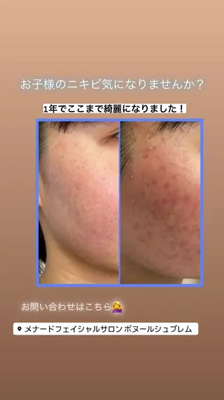 メナードフェイシャルサロン ボヌールシュプレム所属・谷口 仁美のその他イメージ