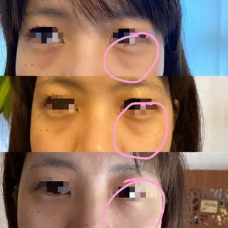 Meetite 小林のエステ・リラクイメージ