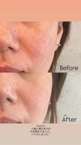 Joo🌿ナツキ 肌育/エイジングのその他イメージ