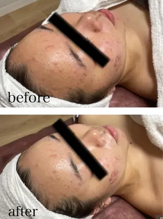 ビューティーサロン B.glossyのネイルデザイン