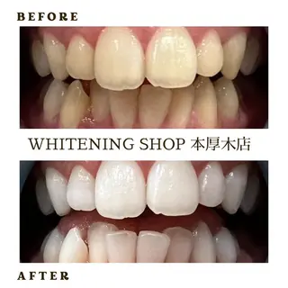 メンズ ホワイトニング ショップ本厚木のその他イメージ