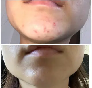 食べながら魅せボディ éclatJua川越のエステ・リラクイメージ