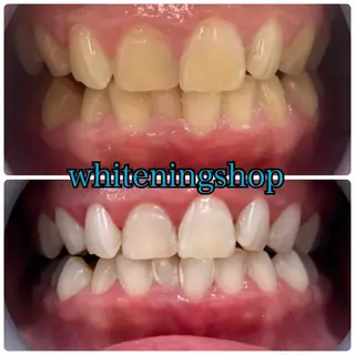 ホワイトニング ショップ伊丹店のその他イメージ