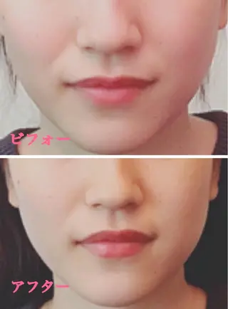 小顔サロン ソ.ルシエのエステ・リラクイメージ