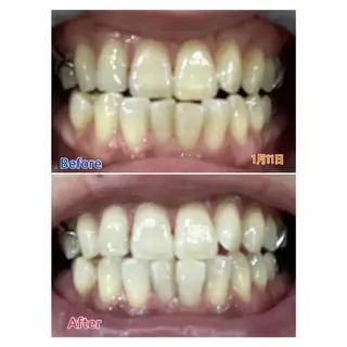 Ｍ渋谷 ホワイトニングのエステ・リラクイメージ