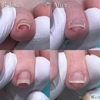 巻き爪アカデミー 溝の口のネイルデザイン