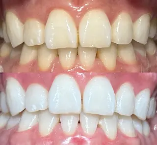 io teeth careのその他イメージ