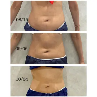 心斎橋🤍堀江.小顔 ハーブ.痩身クレビアのエステ・リラクイメージ