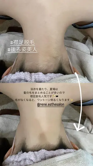 Rene 慢性疲労ケアサロンのエステ・リラクイメージ