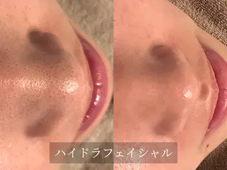 脱毛サロン Arumのエステ・リラクイメージ