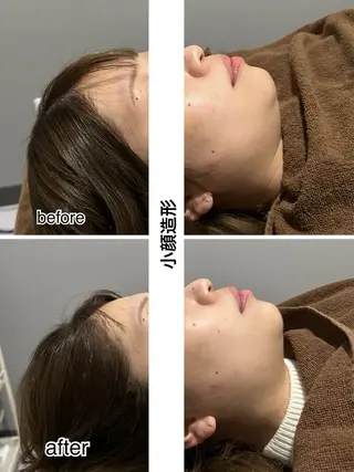 ENCHANT 脱毛.小顔.毛穴のエステ・リラクイメージ