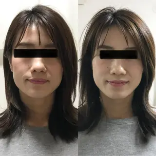 マッツンの 鍼のその他イメージ