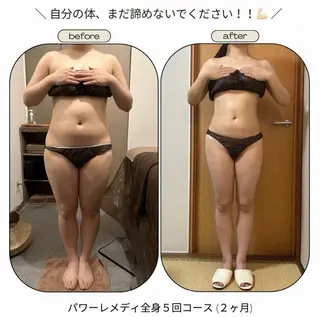 《本気痩せ×疲労改善 》  BILOOPのエステ・リラクイメージ