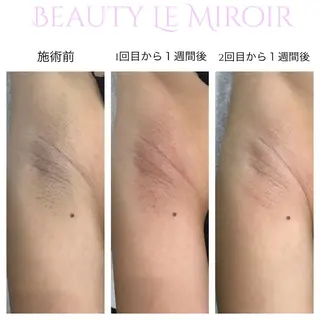 ビューティー ミロワールのエステ・リラクイメージ