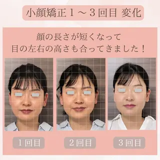 ハーブ蒸し小顔矯正 サロンLinoのエステ・リラクイメージ