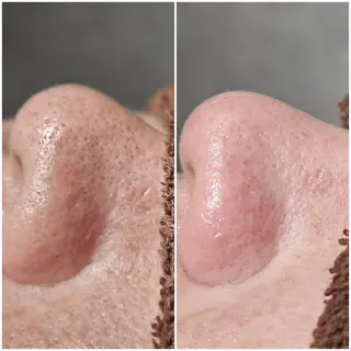 Iryアイリー所属・Iry アイリーのエステ・リラクイメージ