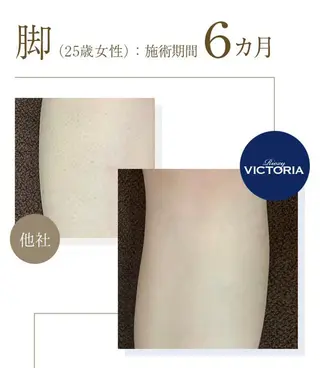 Butterfly 津田沼店　松井のエステ・リラクイメージ