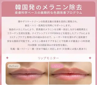 KIRAN 山﨑のエステ・リラクイメージ