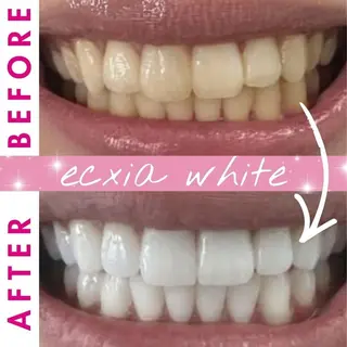 セルフホワイトニング エクシア渋谷原宿店のその他イメージ