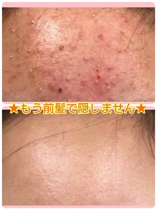 ハーブピーリング 専門店Kikkaのエステ・リラクイメージ