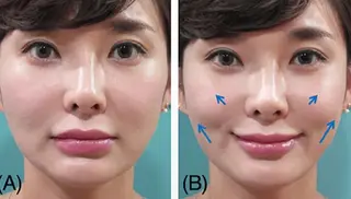 ネイル aliaハーブ水光店 エステティシャン募集のエステ・リラクイメージ