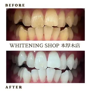 メンズ ホワイトニング ショップ本厚木のその他イメージ