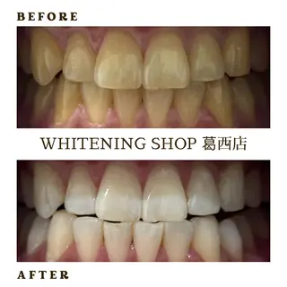 メンズ ホワイトニング ショップ葛西店のその他イメージ