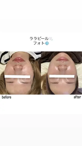 salon merci和泉のエステ・リラクイメージ