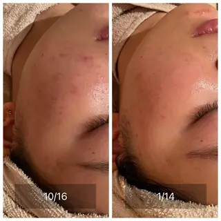 CHERIE Hisadaのエステ・リラクイメージ