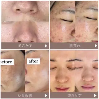 WHITE AQUA 🌼柏店のエステ・リラクイメージ