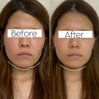 salon  Stellum所属・Stellum 小顔矯正&ヘッドスパのエステ・リラクイメージ