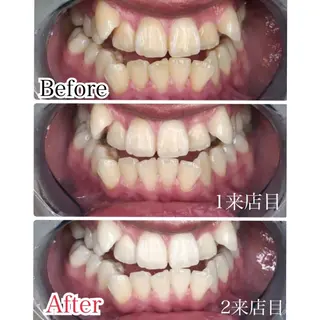 プラチナムビューティー柏所属・【歯科提携】柏ホワイ トニングスタイルのその他イメージ