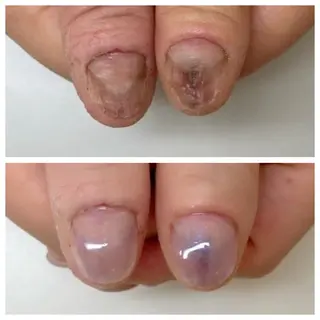 ネイル ネイルサロン アリュームのネイルデザイン