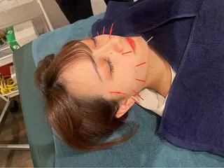 nano.face名古屋駅前店所属・美容鍼/小顔&整体 nano.faceのエステ・リラクイメージ