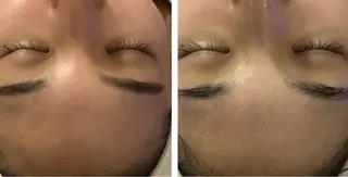 エステfreep takamoriのエステ・リラクイメージ