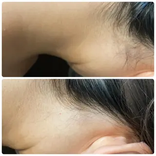 メンズ&レディース美容脱毛専門LEPIAつくば店所属・廣木 麻衣子のエステ・リラクイメージ