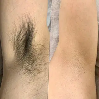 脱毛・小顔専門サロンLUANA所属・脱毛&シェービング 専門店　平岡のエステ・リラクイメージ