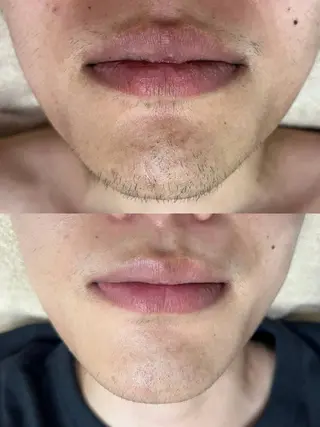 韓国美肌/肌質改善 【天神】のエステ・リラクイメージ