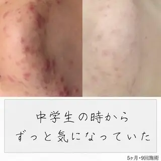 ニキビ経験者が施術 する専門サロン🌻のエステ・リラクイメージ