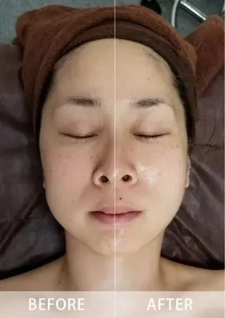 美肌，美ボディ，脱毛 サクラチャンスパのエステ・リラクイメージ