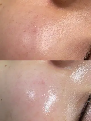 ビューティーサロン Lino🫧mayuのエステ・リラクイメージ