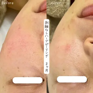 肌質改善サロン renew/ｳｴｷのエステ・リラクイメージ