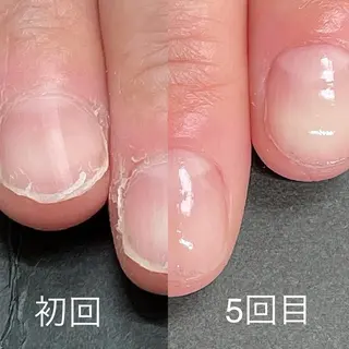 ネイル 関山 志乃のネイルデザイン