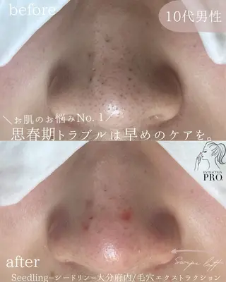 シードリン 府内店 小波のヘアスタイル