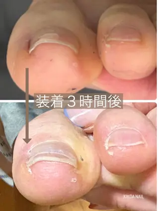 ネイル KIKOA NAIL キコアネイルのネイルデザイン