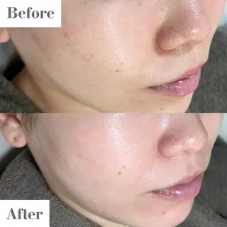 SALON DE UNI所属・uni. RYOKAのエステ・リラクイメージ